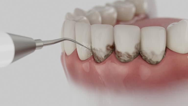 Trusted Emergency Dentist service in Hopkins, SC - Dentist Open Now